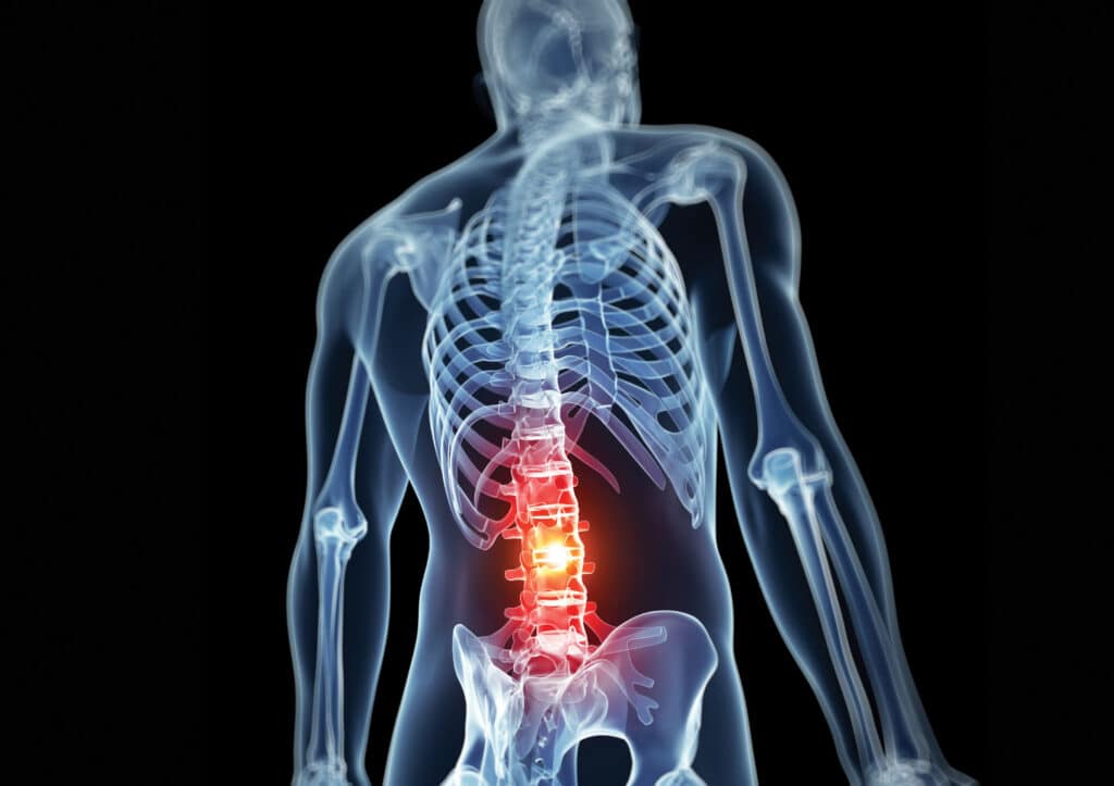 Medical illustration highlighting lower back pain in the lumbar spine region