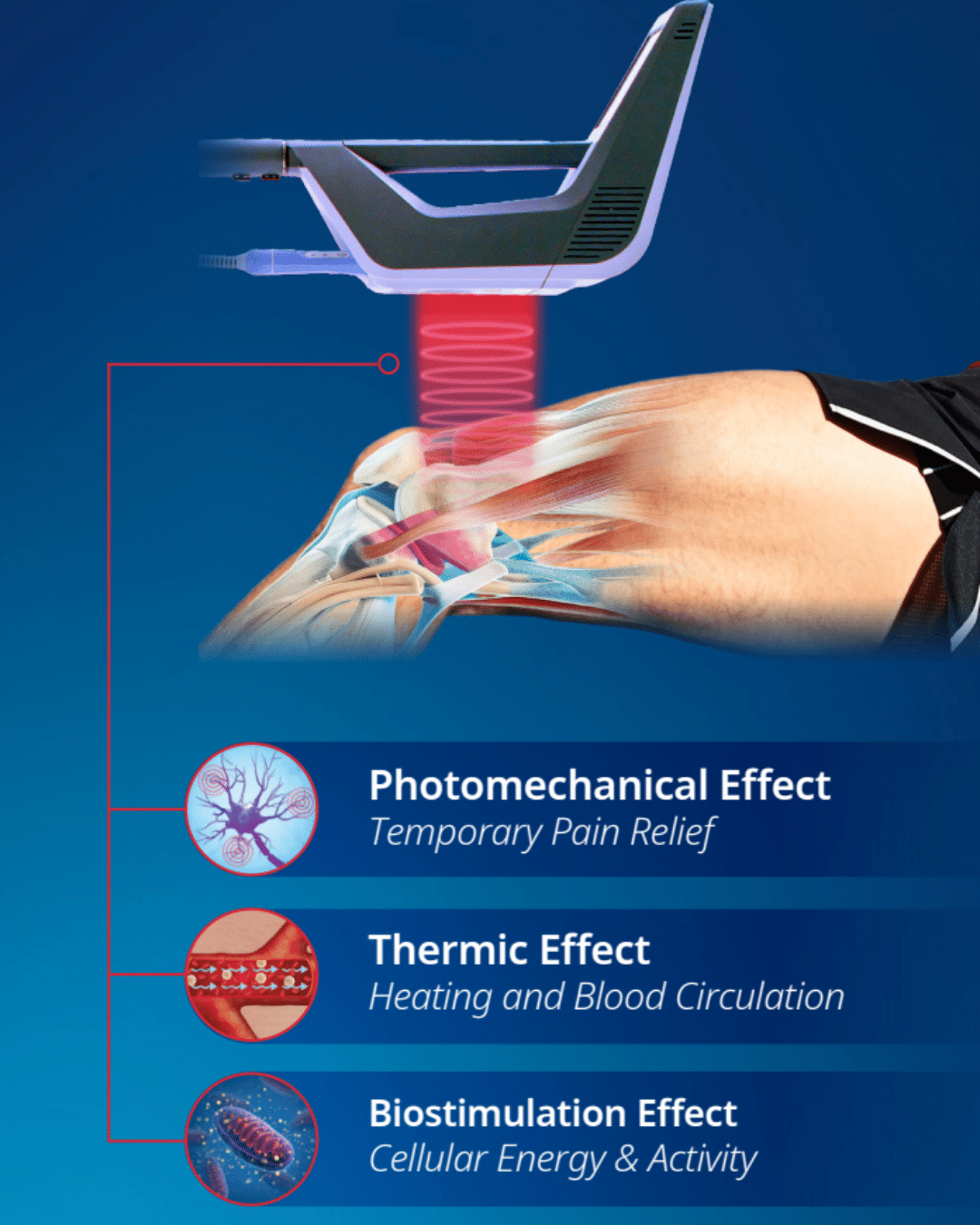 Laser therapy device showing photomechanical, thermic, and biostimulation effects for pain relief and circulation