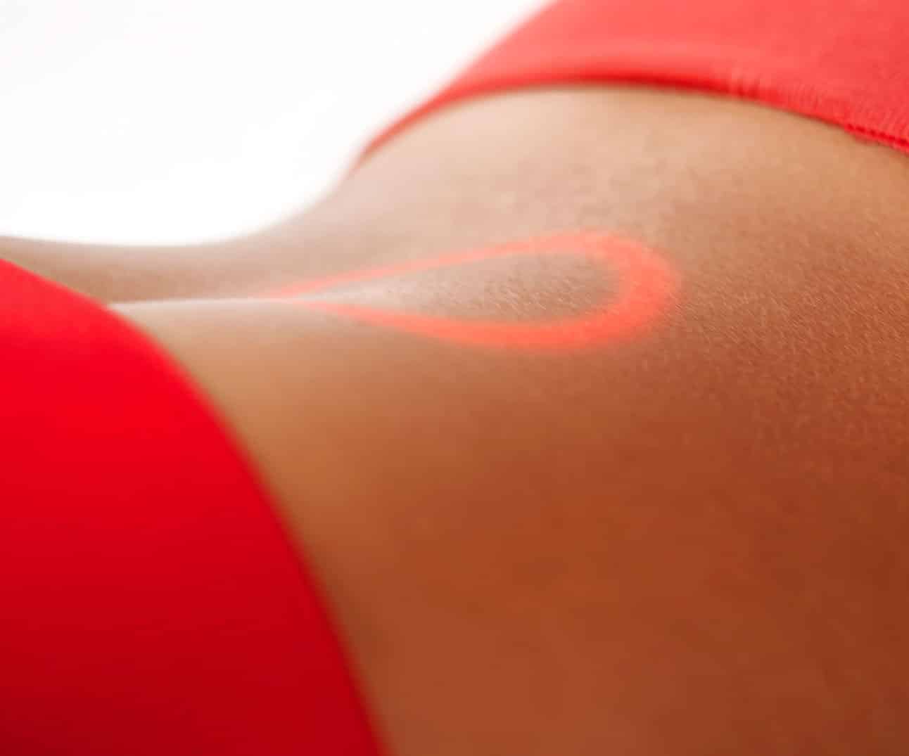 Hands-free laser therapy device treating lower back pain with targeted red light