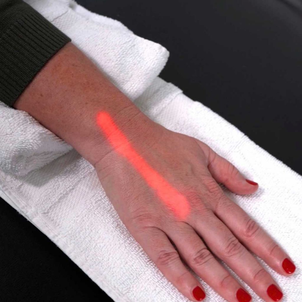 EMVITAL Red laser light treating the back of the hand and wrist for arthritis and joint pain
